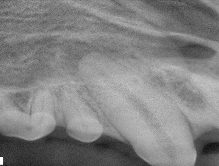 Endodontic Therapy